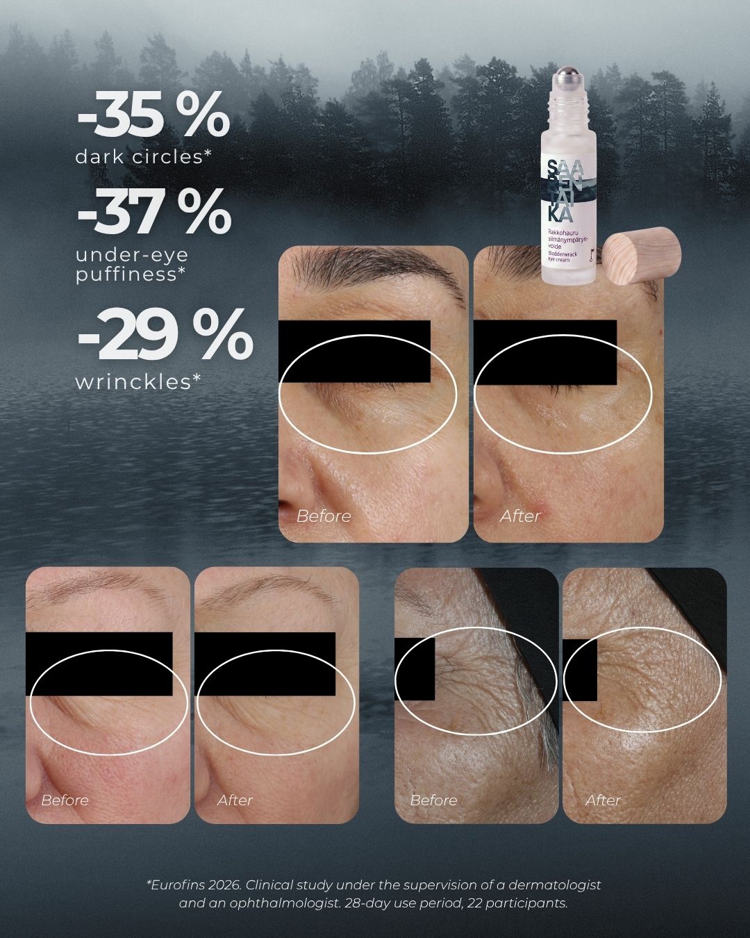 Bladderwrack Eye Cream Roll-On: Clinical Study Under Dermatological and Ophthalmological Supervision