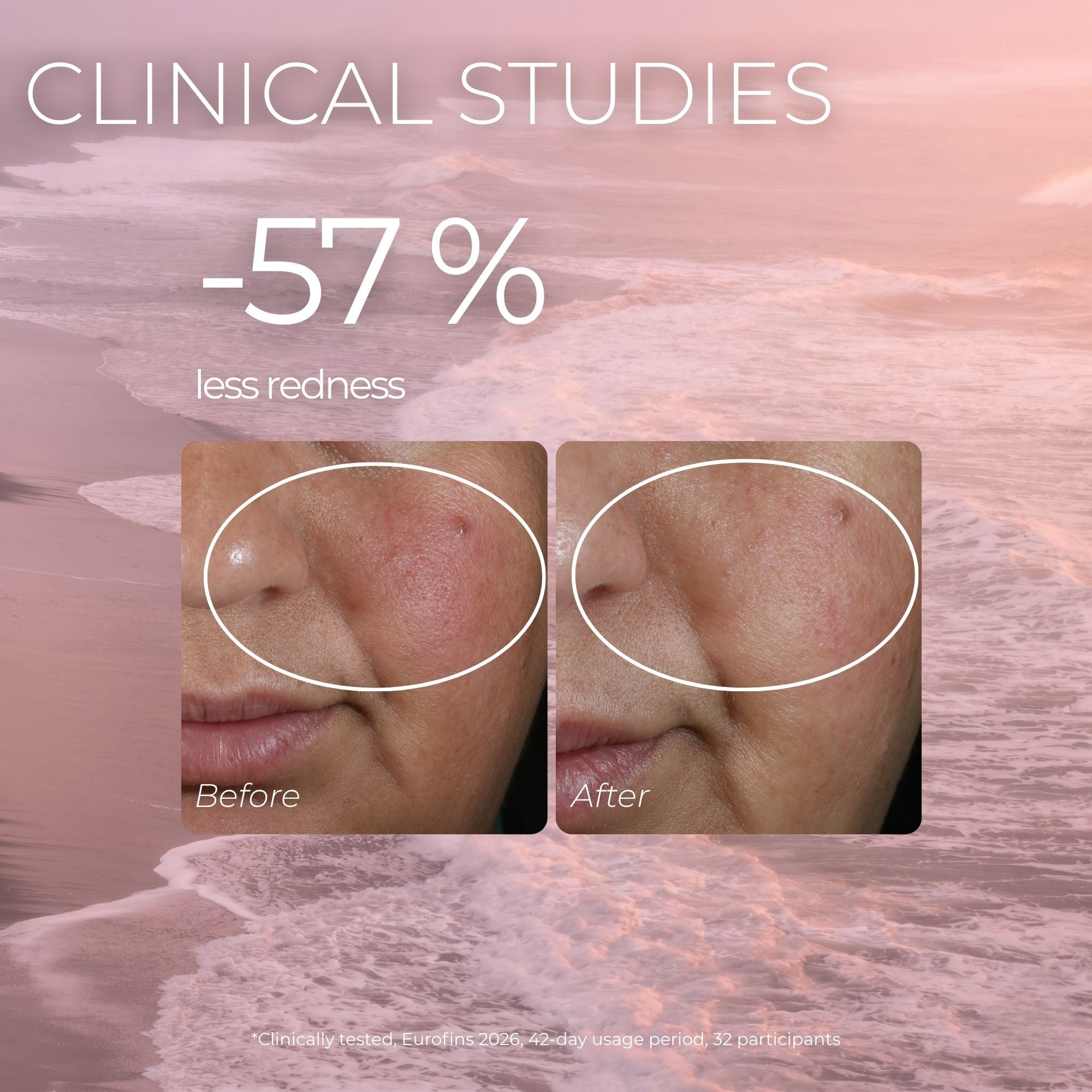 Why Redness Comes Back and What Actually Calms It