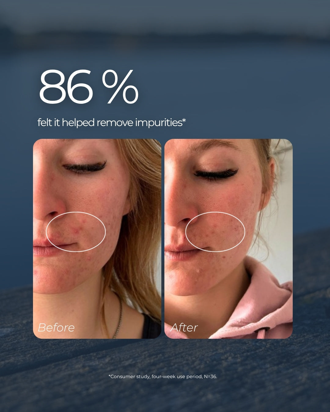 Before and after Saaren Taika Brightening Micro-Exfoliant: 86% felt it helped remove impurities in a four-week consumer study