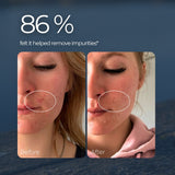 Before and after Saaren Taika Brightening Micro-Exfoliant: 86% felt it helped remove impurities in a four-week consumer study