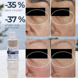 Bladderwrack Eye Cream Roll-On for Puffiness, Dark Circles and Expression Lines