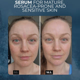 Bladderwrack Super Serum – Uppstramande, utjämnande och ljusare serum för mogen hud, även lämplig för atopisk, rosacea-benägen och blemishbenägen hud, UNISEX, 30 ml