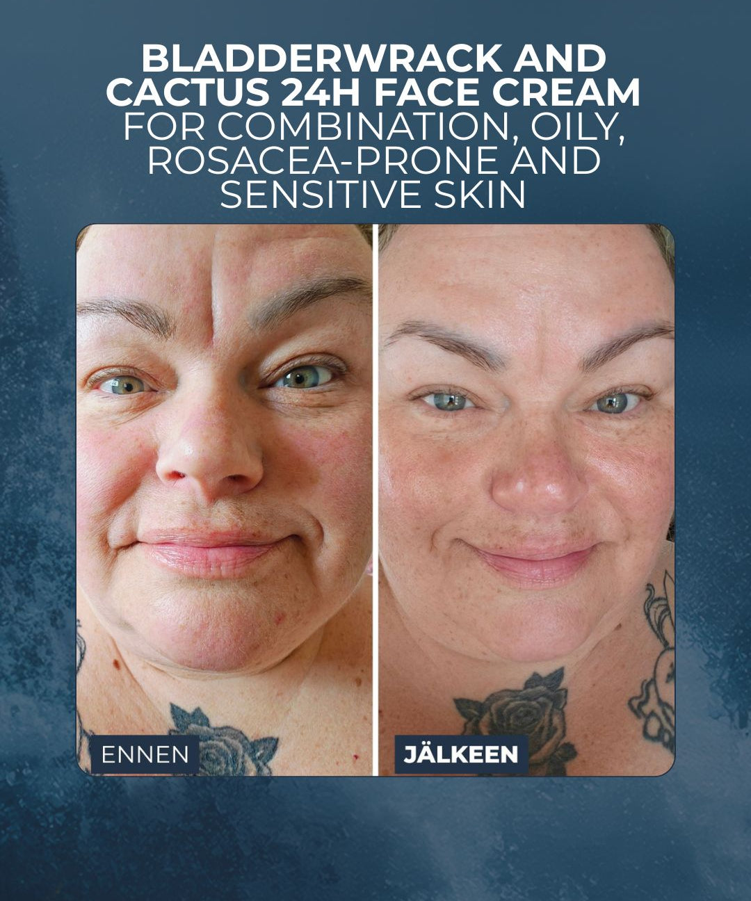 Blasentang & Kaktus 24H Gesichtscreme für Mischhaut, fettige, zu Rosacea neigende und empfindliche Haut