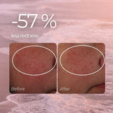Redness Relief Serum for Rosacea, Couperose and Reactive Skin