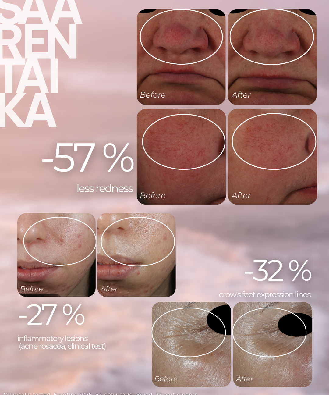 Redness Relief Serum for Rosacea, Couperose and Reactive Skin