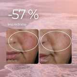 Redness Relief Serum for Rosacea, Couperose and Reactive Skin