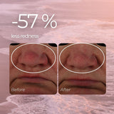 Redness Relief Serum for Rosacea, Couperose and Reactive Skin