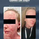Archipelago Salt Soap®, for skin prone to psoriasis, eczema and atopic dermatitis, unscented, 100% natural
