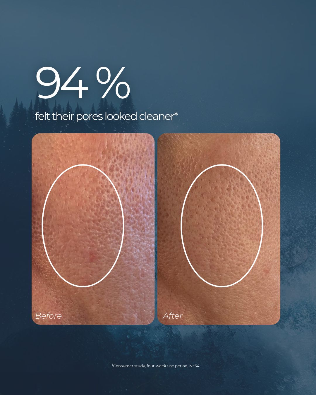 Before and after Saaren Taika Deep Cleansing Face Mask: 94% felt their pores looked cleaner in a four-week consumer study